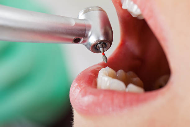Best Emergency Orthodontic Repairs in Mccaysville, GA